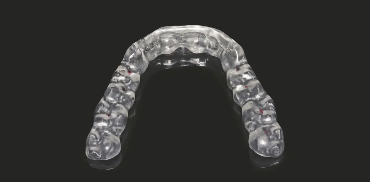 Digital Workflow in Oral Splint Manufacturing