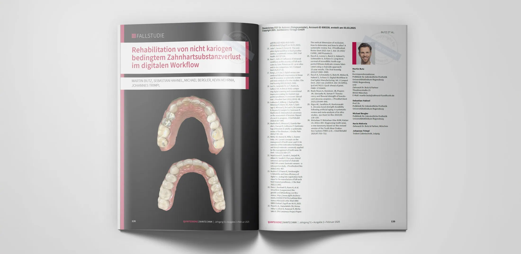 Rehabilitation von nicht kariogen bedingtem Zahhartsubstanzverlust im digitalen Workflow